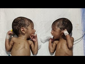 Neonatal Care Basics | Essential Newborn Tips for Parents and Nurses