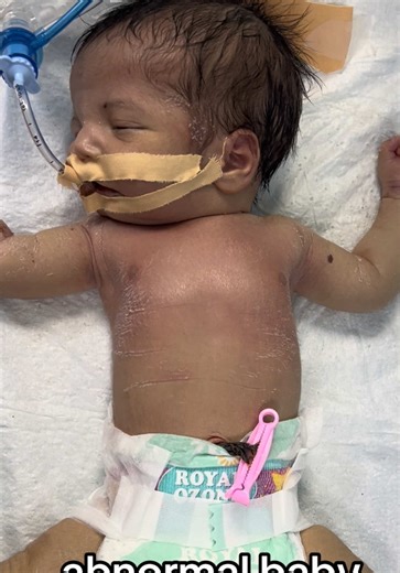 abnormal baby not responding #usa #newborn #pleasepray #unfreezemyaccount #27weeks