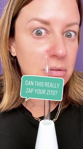 Pimple Popping Tools Review | Onda Pure Skin vs Nu-Wand vs Derma-Wand Pro