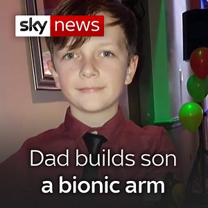 169K views · 1.4K reactions | Faced with an 18-month wait for a bionic arm, Jamie's dad bought a 3D printer and created nine bionic arms for his son | Sky News | Facebook