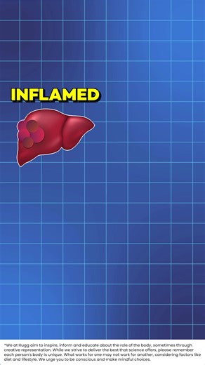 18K views · 93 reactions | Liver ki charbi ka natural sujhaav  Apke report main triglyceride ka number 150 se zyada hain, toh yeh juice try kijiye. More on: https://gethugg.com/kalmegh-bitters-for-fatty-liver/ | Hugg | Facebook