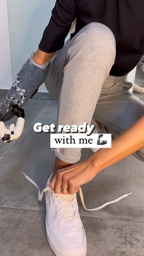 130K views · 112 reactions | grwm - amputee edition 料懶 #fyp - #amputee #amputeegirl #amputation #amputeelife #proud #fyp #fypシ #viral #tiktok #video #reels #amputada #diversity #bioggerrfun #love #beautiful #fashion #motivation #zweitertagneuerlook | wioletta.wyr | Facebook