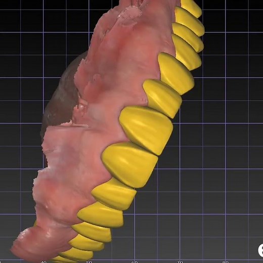 instalación de programas de exocad #exocad