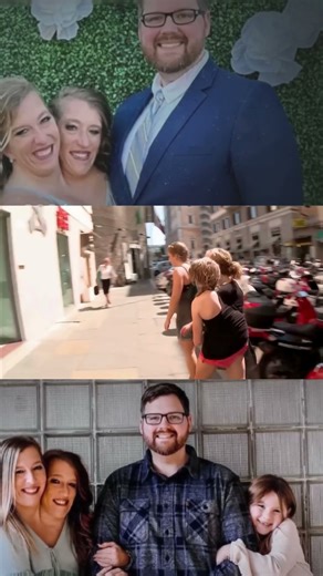 Abby Hensel’s Marriage Revealed: Life, Love, and Individuality of the Conjoined Twins #subscribe