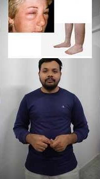 Glomerulonephritis – Kidney lo Inflammation | Symptoms, Causes & Treatment Explained in Telugu