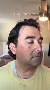 Saul grew up in South Padre Island—endless sun, salt air, and true beach-kid days. Like many of us, sunscreen wasn’t part of the routine back then… and this is exactly why it matters. UV exposure is cumulative. Even when you don’t burn, ultraviolet radiation penetrates the skin and stimulates excess melanin production, leading to sun damage, uneven pigmentation, and premature aging over time. It also breaks down collagen at the cellular level, which impacts skin texture, firmness, and overall to