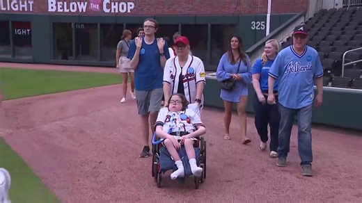 'Above and beyond' | Georgia teen who faces challenges medically spends day with Atlanta Braves
