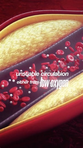 Dr. Vinod Kumar on Instagram: "Foot Color Changes You Should Never Ignore | Circulation Warning Signs If you ever notice your feet turning red, blue, or pale, it’s not random. These color changes can be a clear sign of unstable blood circulation in your legs and feet. In this video, we explain how changes in foot color may signal low oxygen levels or slow blood return. Poor circulation often shows early signs in the feet, and many people overlook them until the problem gets worse. Checking the c