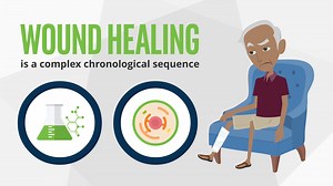 Wound Healing Animation - Surgery