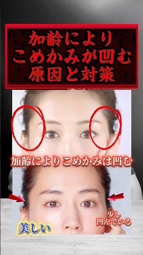 【加齢によりこめかみが凹む原因と対策が分かります！】