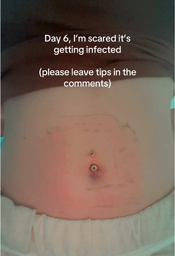 #fyp #bellybutton #piercing #tips #day4 #healing #navelpiercing #viral #getthistothetargetaudience #help #blowmeup #secretaccount #makemefamous