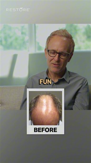 Hear Robby’s real hair restoration story and see how follicular unit extraction can restore thinning hair naturally. Learn more about FUE hair transplants, real patient results, and what’s possible at @Restore_Hair. #hairtransplant #fuehairtransplant #hairrestoration #thinninghair #hairlossjourney #menshairloss #recedinghairline #realresults #beforeandafters #fue #restore