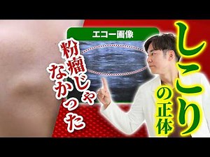 粉瘤じゃない？！【脂肪腫とは？】皮下のしこりの特徴・粉瘤との見分け方を皮膚科専門医が解説
