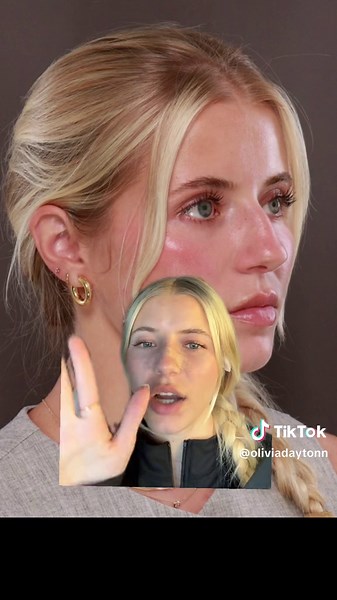 Nose Job Recovery: Swelling and Scar Tissue Update