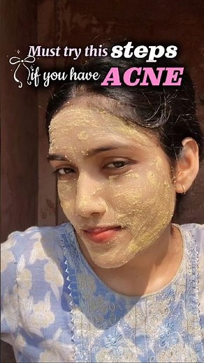 4-Steps Acne Facial At Home✨ Pimple & Oily Skin Care Routine #acne #pimple #skincare