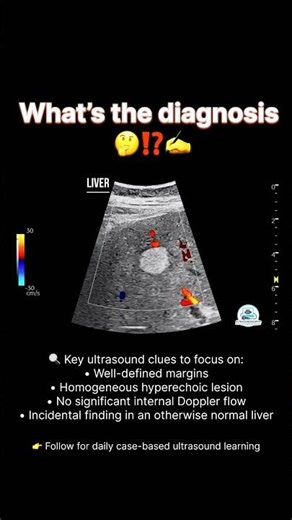 What’s the Diagnosis? | Color Doppler Ultrasound 🩻