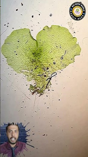 Plant that Looks Like a Heart | Under Microscope #viral #viralshorts