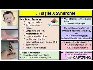 FRAGILE X SYNDROME, CAUSES, CLINICAL FEATURES, RISKS, DIAGNOSIS, MANAGEMENT
