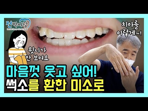 웃을 때 잇몸이 안 보여요...😭😭 잇몸 좀 찾아주세요✅