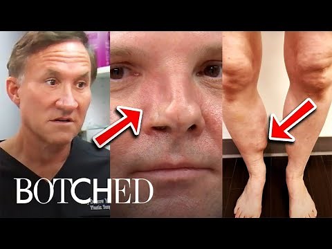 7 Most MEMORABLE "Botched" Moments of 2021 | Botched | E!
