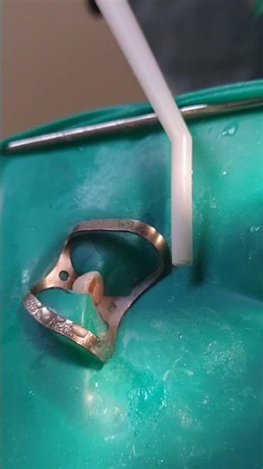 Sandblasting 22 teeth.#abrasiveblastingtooth #sandblastingtooth