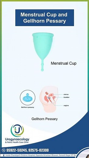 Gellhorn Pessary and Menstrual Cup