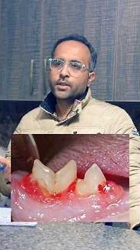 Dental Resorption in Cats | Why Your Cat Is Not Eating Properly 😿 | Home Care & Vet Treatment