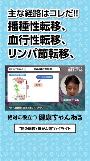 癌の転移と抗がん剤 ハイライト