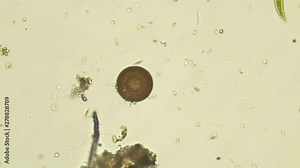 Arcella's amoeba under a microscope, usually found in fresh water and mosses, feeds on diatom algae, single-celled green algae or protozoa such as flagella and ciliates
