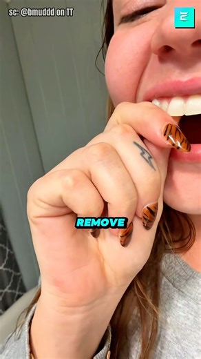 Vampire Teeth That Can't Be Removed!