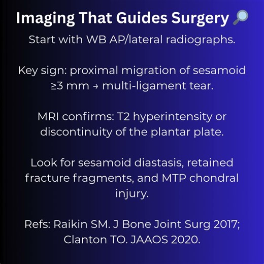 Turf Toe isn’t “just a sprain.”