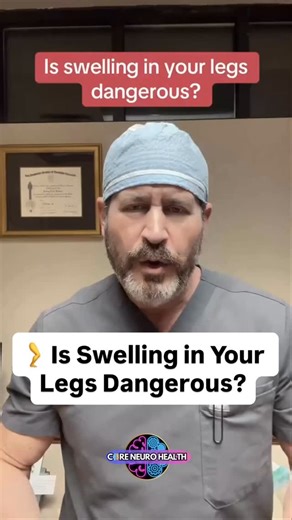 @coreneurohealth1 | Swollen legs might seem harmless — especially after a long day standing — but persistent or unexplained swelling can be a sign that your... | Instagram