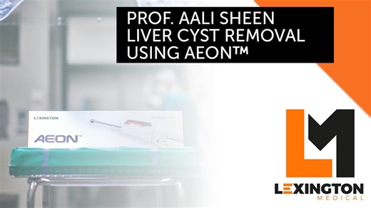 Laparoscopic Liver Cyst Removal by Prof. Aali Sheen Using the AEON Endostapler
