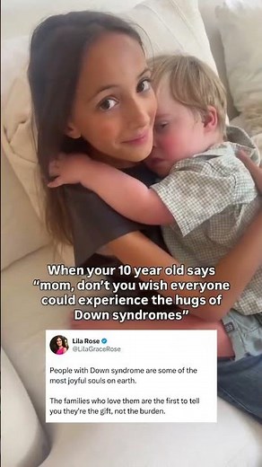 Down syndrome babies are blessings