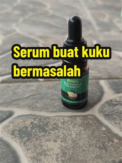 Obat Cantengan Terbaik: Serum Kuku & Tips Mengobati