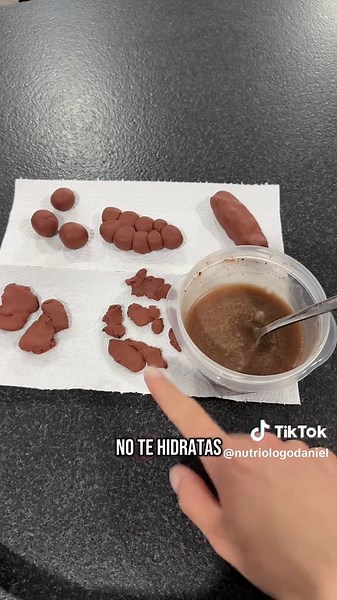 Tipos de popó: Aprende sobre las heces