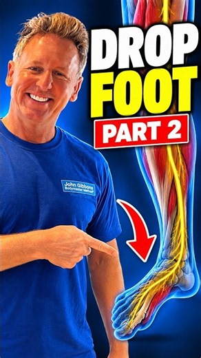 Drop Foot - (Part 2)