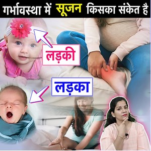Swelling During Pregnancy - Why This Happens And Is It A Baby Boy Symptom | Pregnancy Tips and Information