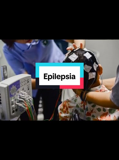 Entendiendo la Epilepsia: Definición y Síntomas