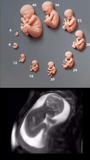 Fetal Development Insights at 32 Weeks Pregnant