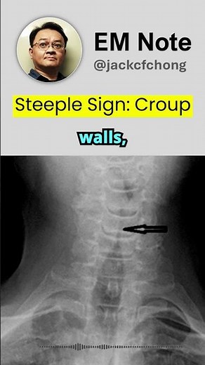 Steeple Sign of Croup