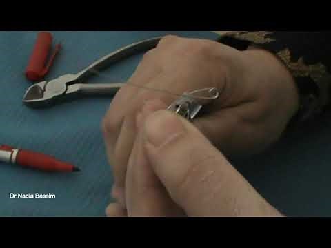 Recurved z spring