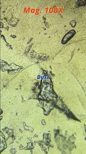 Nose rust under the microscope | TULO - Microscope #shorts #microscope #bacteria #nose