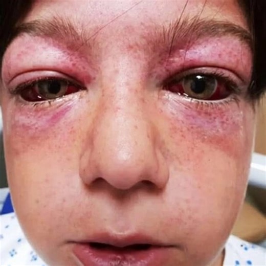 11-year-old found unconscious and ”looking like an alien”, then mom learns horrific truth and shares a warning for all parents...Check comments 👇🏻😢 | InStyle Fashion One