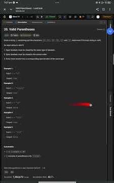 Valid Parentheses Explained | Why Stack is Used? | Coding Interview Question 🚀