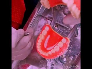 Basic Periodontal Examination ( BPE )