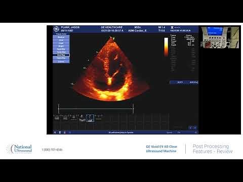 GE Vivid E9 XD Clear Post Processing Features Training Video