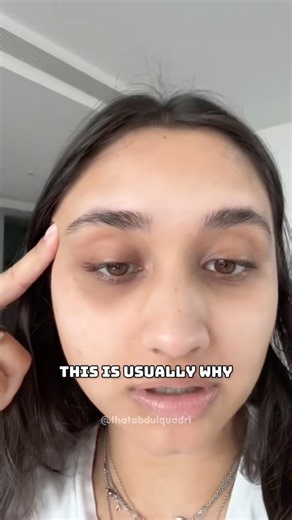 How to get rid of under eye bags #darkeyes #undereyebags #shortsfeed