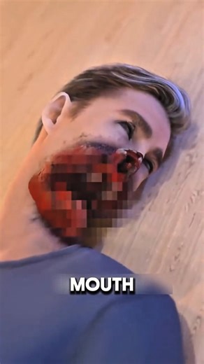 Exploding Chewing Gum Claims the Life of a Student #shorts