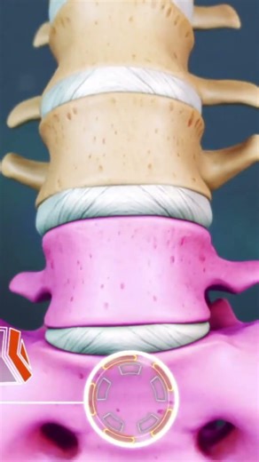 L4-L5 and L5-S1 disc problems